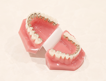 桑名駅徒歩3分の山本矯正歯科の裏側矯正 | 桑名市で矯正治療をお考え